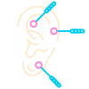 auriculoterapia